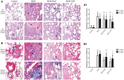 Astragaloside IV Improves Bleomycin-Induced Pulmonary Fibrosis in Rats by Attenuating Extracellular Matrix Deposition